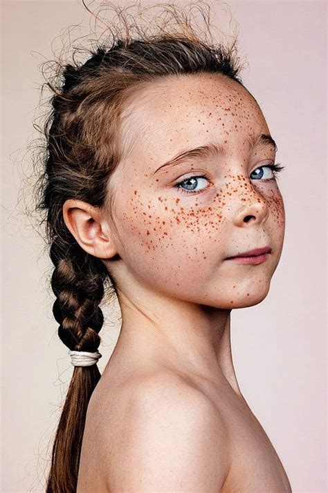 These Portraits Celebrate The Joy Of Having Freckles Sommersprossen