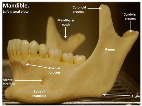 Mandible Lateral View With Labels Axial Skeleton Visual Flickr