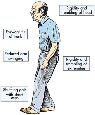 We did not find results for: PARKINSONS DISEASE - ACTIVE CARE PHYSIOTHERAPY CLINIC