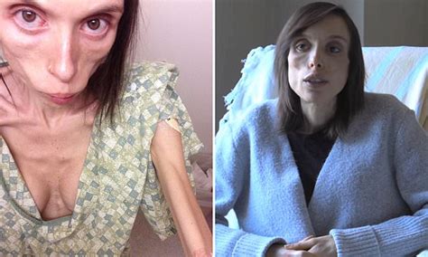 Anorexia Sufferer Describes Her Devastating Battle Daily Mail Online