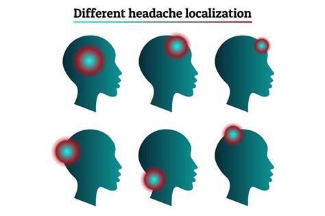 Primary Vs Secondary Headaches In The Emergency Department Pedmore