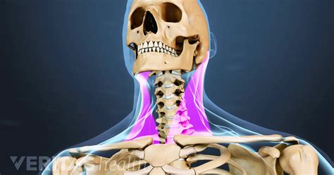Neck Strain Causes And Remedies