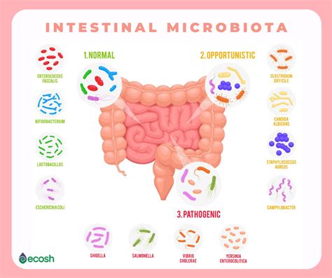 Imbalance Of Gut Microbiota Gut Dysbiosis Symptoms Causes