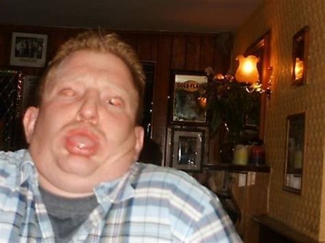 Let fat people die to save the USA billions? | Page 4 | Grasscity Forums