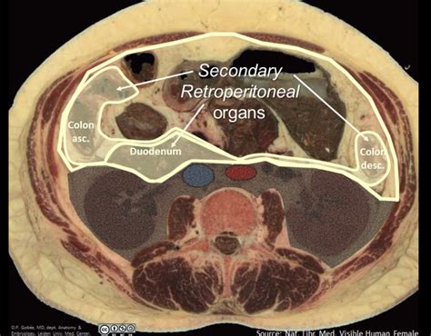 Secondary Retroperitoneal Anatomytool