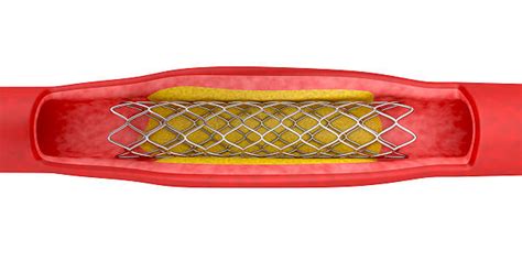 Royalty Free Stent Pictures Images And Stock Photos Istock