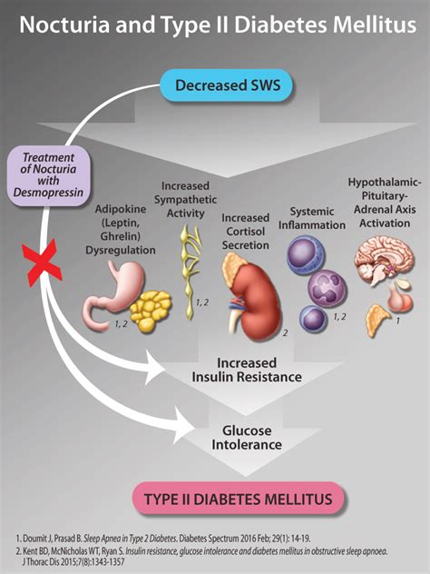 Type 2 diabetes affects more than 29 million americans. Desmopressin | healthPlexus.net