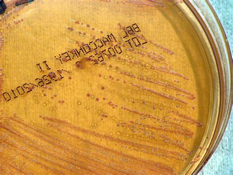 While some infections are subclinical, others result in localized acute or chronic disease, or fatal septicemia. Free picture: pseudomallei, melioidosis, thailandensis ...