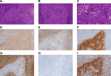 Frontiers Case Report Clinicopathological And Molecular