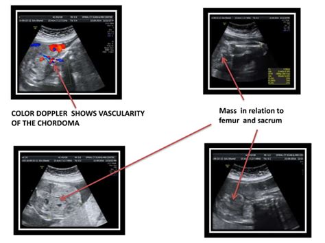 Fetal Anomaly Archive Advanced Usg Lounge