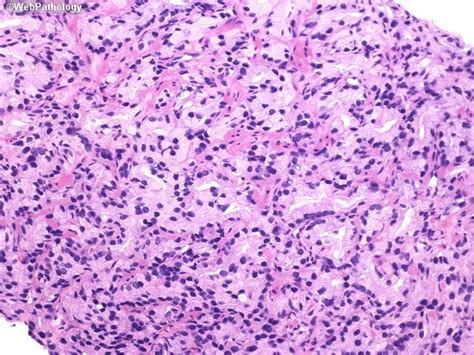 A Collection Of Surgical Pathology Images