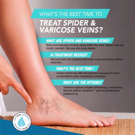 Different Treatments For Varicose Veins The Vein Company