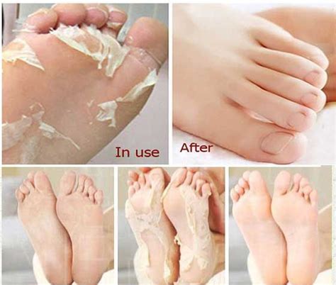 Here Is A Basic Homemade Recipe For Removing Dead And Dry Skin From