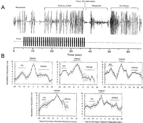 Temporal Structure Of The Myoclonic Seizure Of The Gepr3hsd Rat A