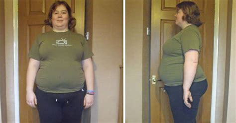Obese Woman Sheds 9st You Wont Believe What She Looks Like Now
