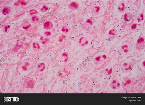 Gram Positive Image And Photo Free Trial Bigstock