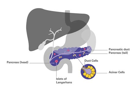 Neuroendocrine Cancer Of The Pancreas Chft