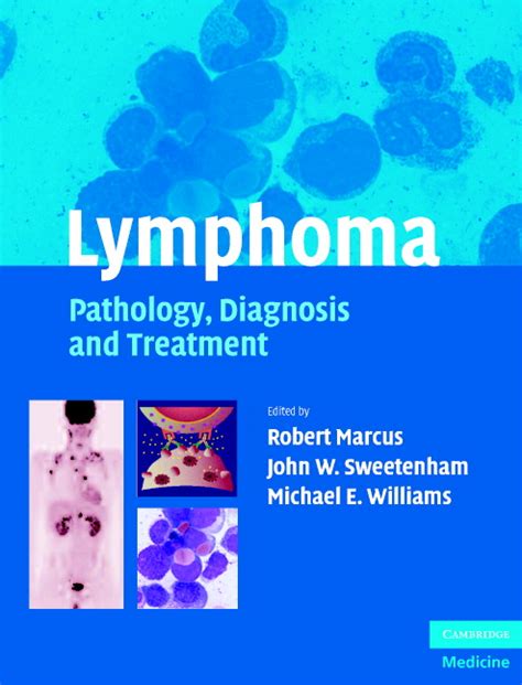 Lymphoma Pathology Diagnosis And Treatment