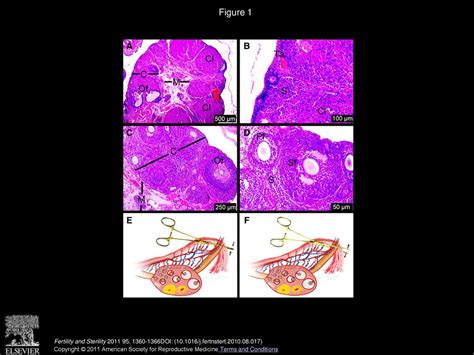 Protective Effects Of Montelukast On Ischemia Reperfusion Injury In Rat