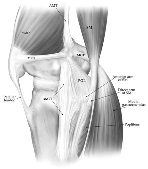 Femoral Condyle Anatomy