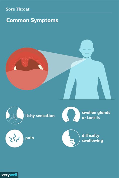 Sore Throat Signs Symptoms And Complications