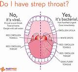 Pictures of Strep Throat Home Remedies For Toddlers