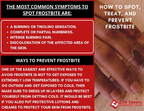 Most Come Symptoms Of Frostbite Life Savers Emergency Room