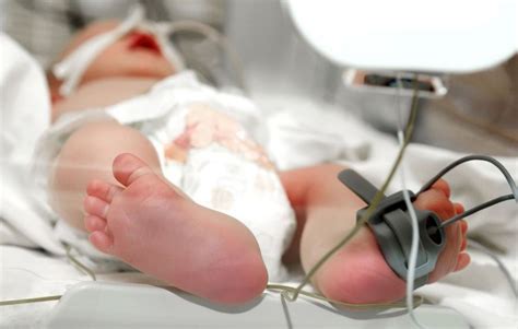 Bebé Prematuro Fue Declarado Muerto En Dos Ocasiones Lo Escuchan