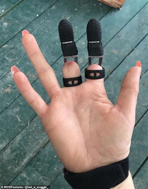 Mom Of Five Lost Two Fingers In A Horrific Woodworking Accident Daily
