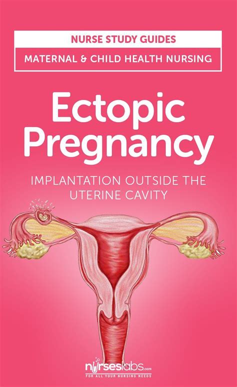 Ectopic Pregnancy Implantation Outside The Uterine Cavity Ectopic