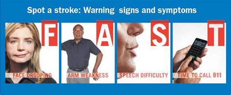 Ischemic Stroke Causes Signs Symptoms And Ischemic Stroke Treatment