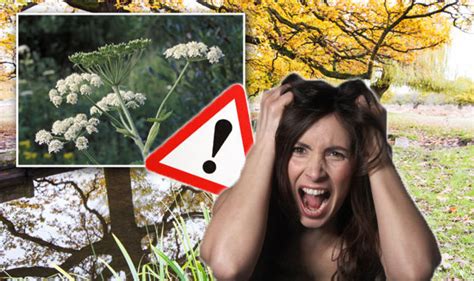 Giant Hogweed How To Avoid Getting A Rash Or Severe Burn Property