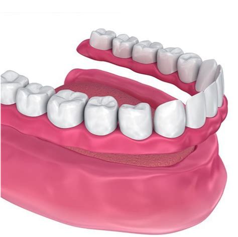 Full Mouth Rehabilitation Cosmetic Dental Implant Centre Cdic Wakad