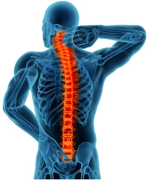 Columna Vertebral M Dula Espinal Espalda Humana Cuerpo Humano Estenosis