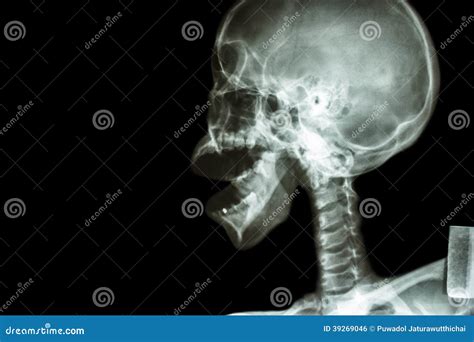 Asian Skull And Open Mouth Stock Photo Image 39269046