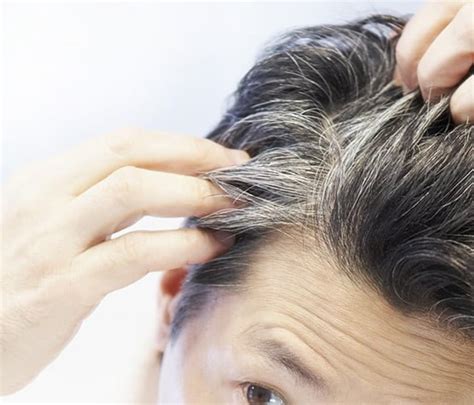 hair graying symptoms causes and other risk factors
