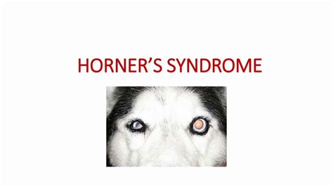Horner S Syndrome Youtube