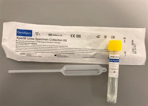 Chlamydia GC PCR Urine MercyOne Laboratory Test Catalog