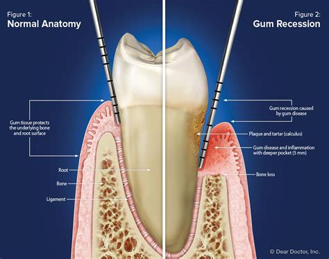 Gum Anatomy
