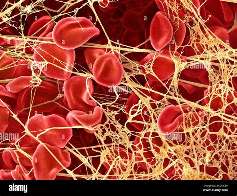Blood Clot Coloured Scanning Electron Micrograph Sem Of Red Blood