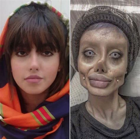 Remember The Zombie Girl Who Wanted To Be Like Angelina Jolie She Posted A Photo To Show Her