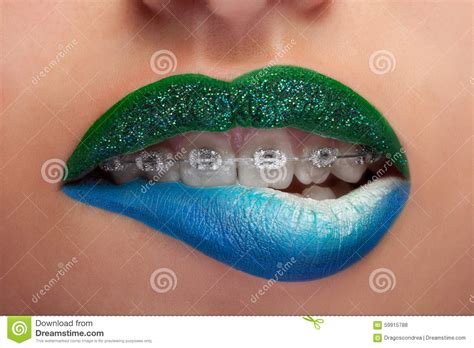 Close Up Mouth Blue And Green Lips With Glitter Brackets Stock Photo