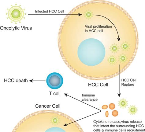 Current And Future Treatment Of Hepatocellular Carcinoma An Updated