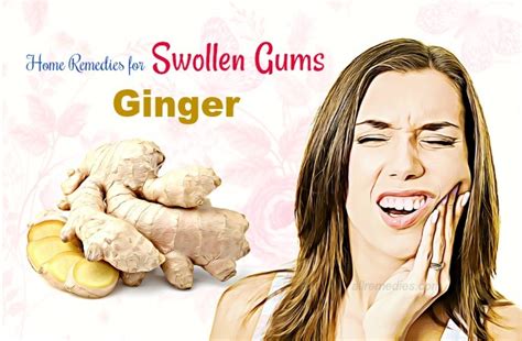 20 Useful Home Remedies For Swollen Gums Around Tooth