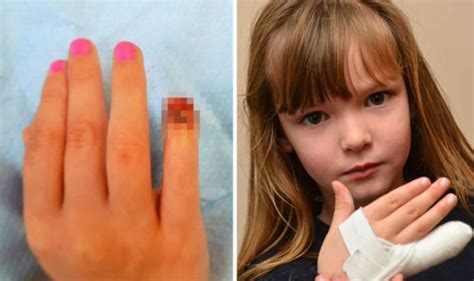 Girl 7 Left Without Tip Of Little Finger After It Was Sliced Off Uk News Uk