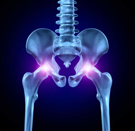It Is Safe To Drive Four Weeks After Total Hip Replacement Surgery