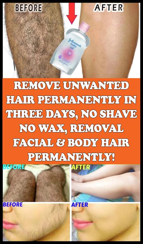 REMOVE UNWANTED HAIR PERMANENTLY IN THREE DAYS NO SHAVE NO WAX REMOVAL