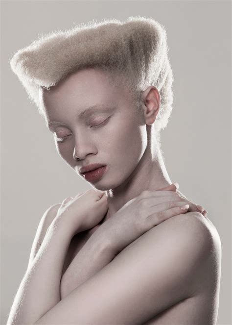 Shaun Ross Y Thando Hopa La Realidad De Los Modelos Africanos Con Albinismo Viste La Calle