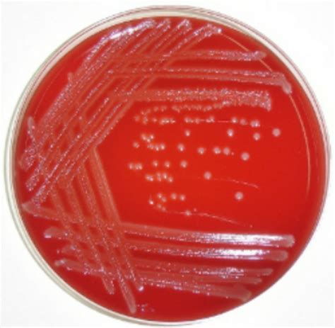Hemolytic streptococci have translucent or opaque, gray, small and mucoid colonies with an area of hemolysis. HBA plate streaked with Listeria . A sterile inoculating loop was used... | Download Scientific ...