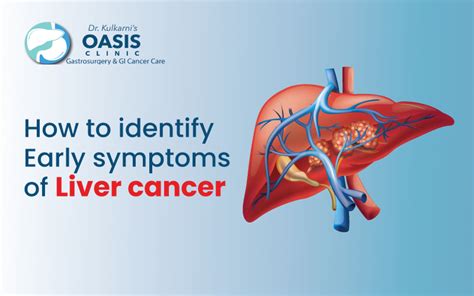 How To Identify Early Symptoms Of Liver Cancer Oasis Clinic